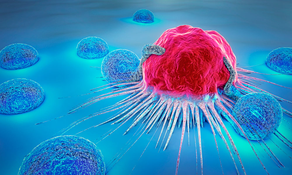 Avances en genética y biología molecular, mejor pronóstico de tumores hematológicos