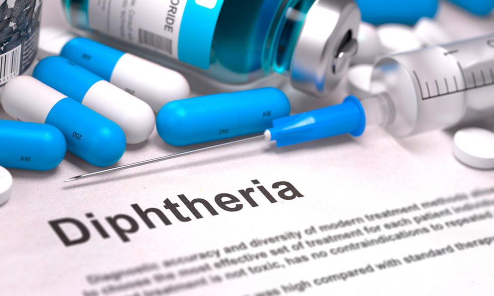 ¿Cómo se trasmite la difteria?