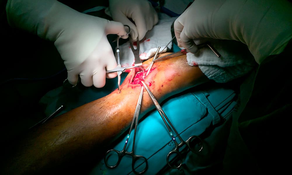 El SAS pagará 25000 euros por una intervención quirúrgica que no tenía que haberse realizado
