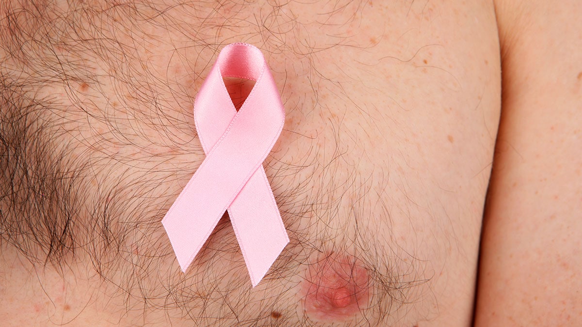 Los hombres con cáncer de mama se enfrentan a altas tasas de mortalidad