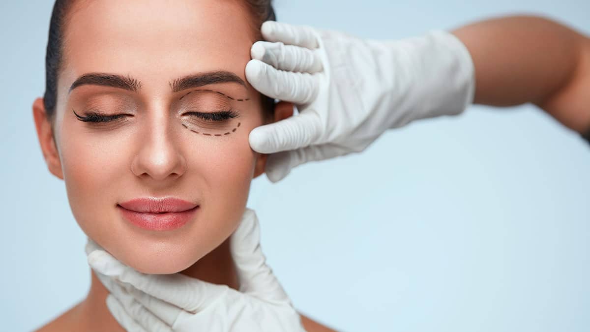 5 casos en los que puede ayudarte la cirugía oculoplástica