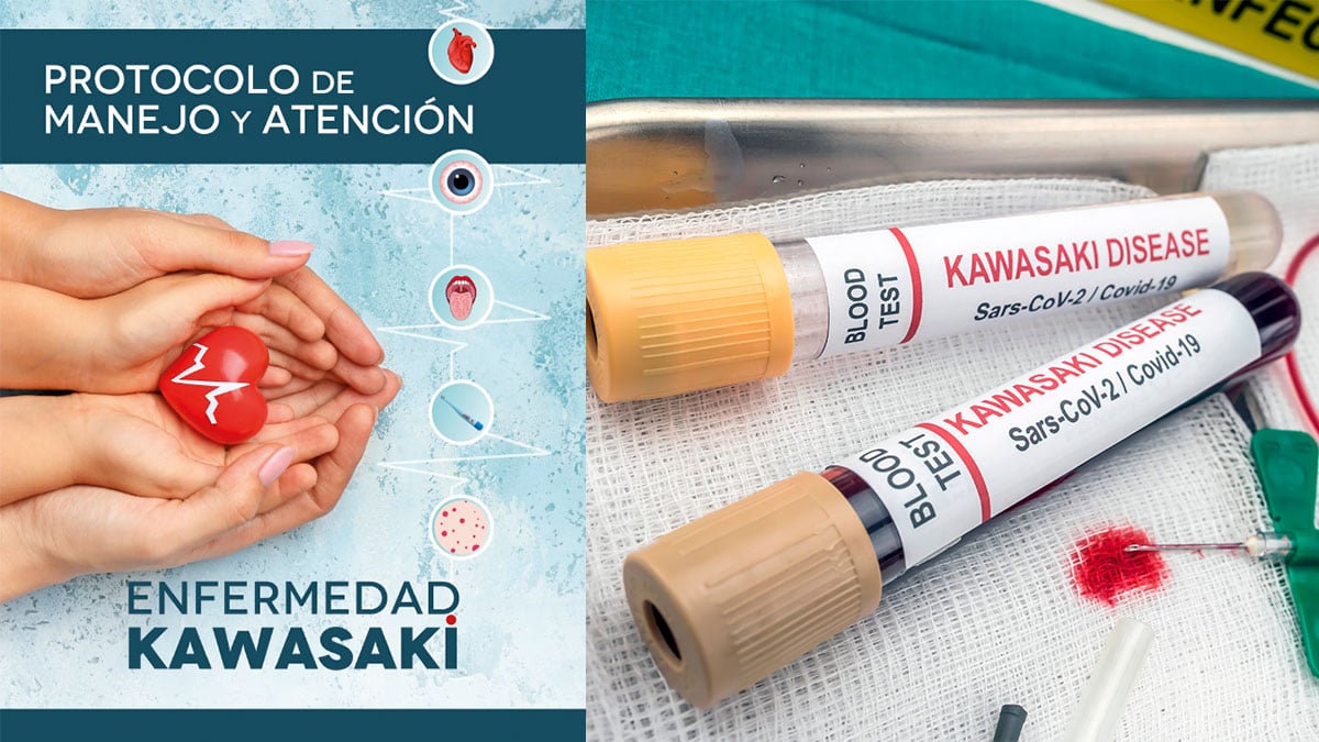 Publicado el primer protocolo de la Enfermedad de Kawasaki