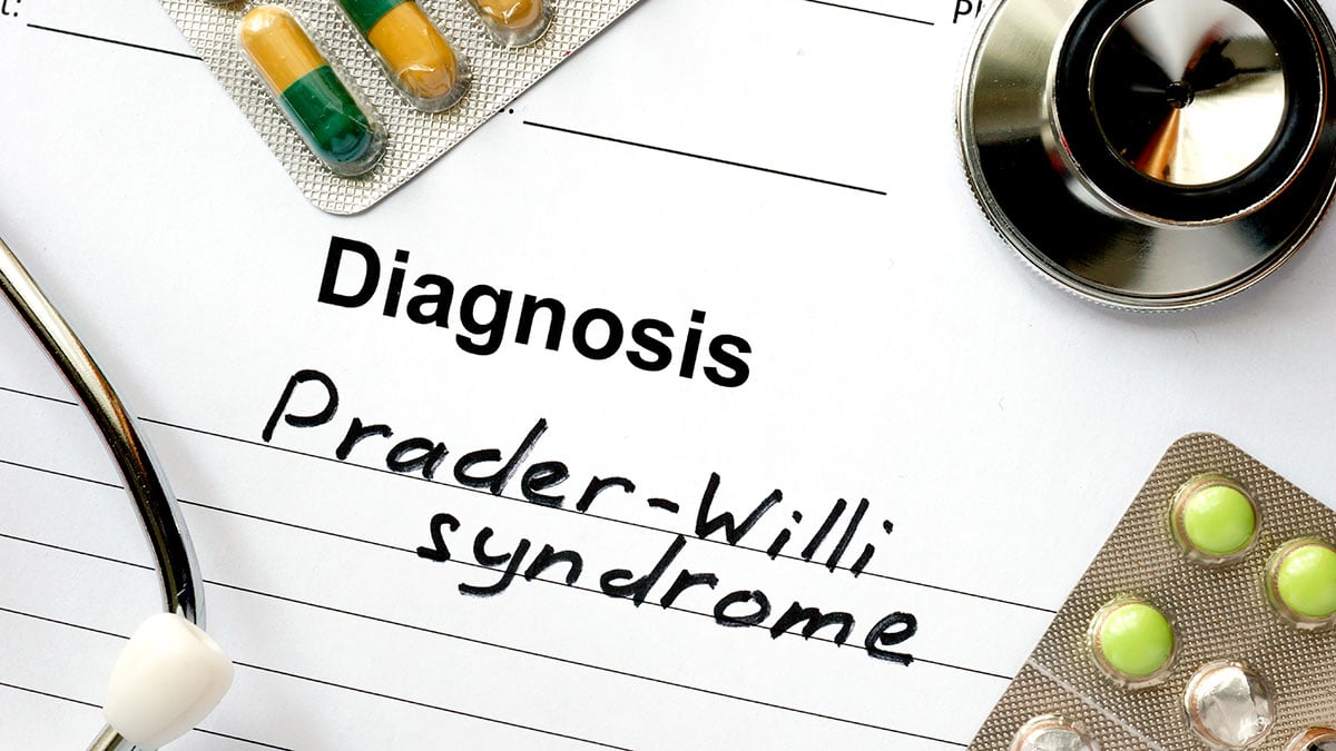 Los endocrinólogos, unidos para registrar a pacientes con síndrome de Prader-Willi y mejorar su calidad de vida